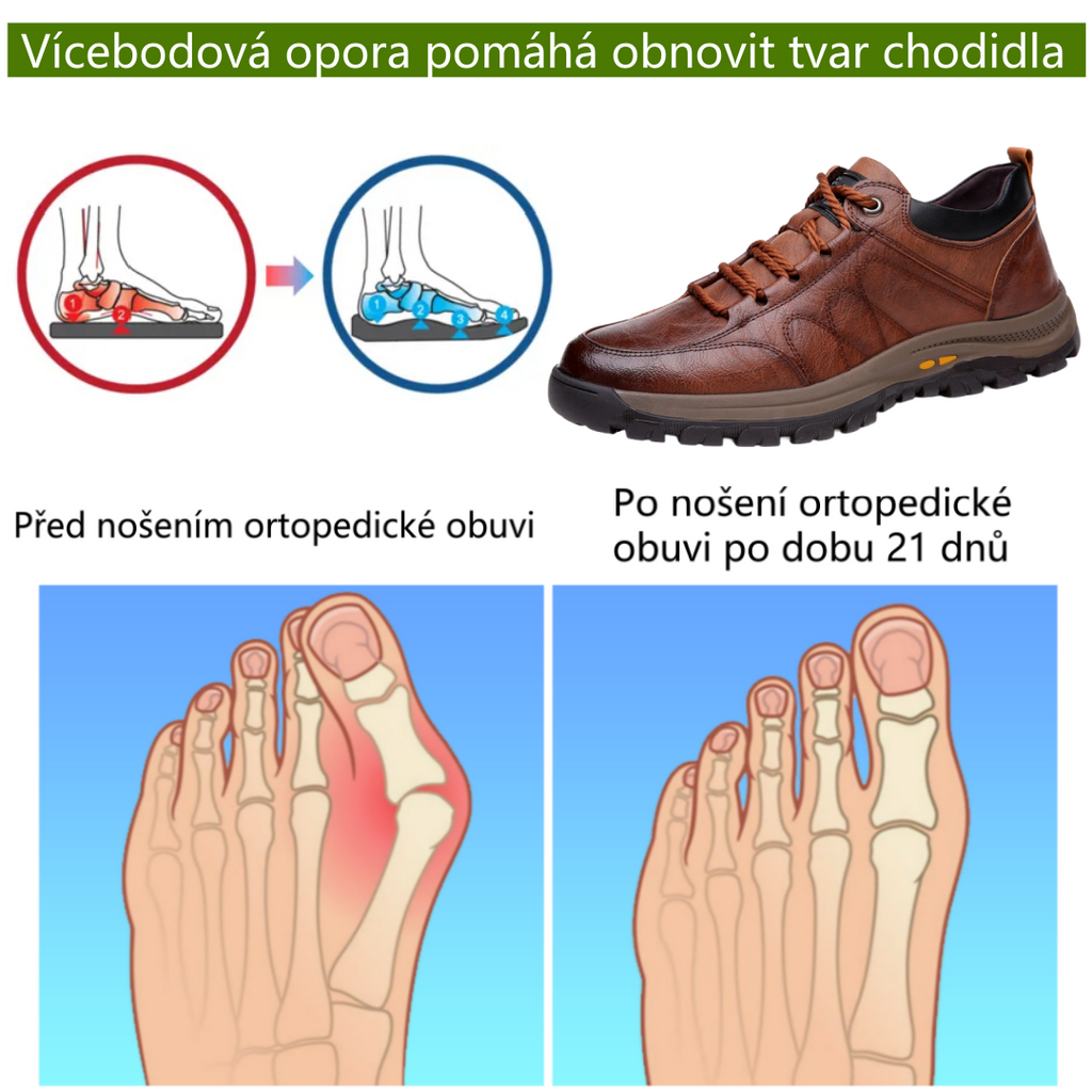 【⏰Časově omezená nabídka: sleva 70 % – Nenechte si ji ujít!】Ergonomická ortopedická obuv – ✅️Koriguje držení těla při chůzi a zmírňuje bolest nohou – Nově vylepšená voděodolnost a protiskluzovost 👞Vybraná australská kůže