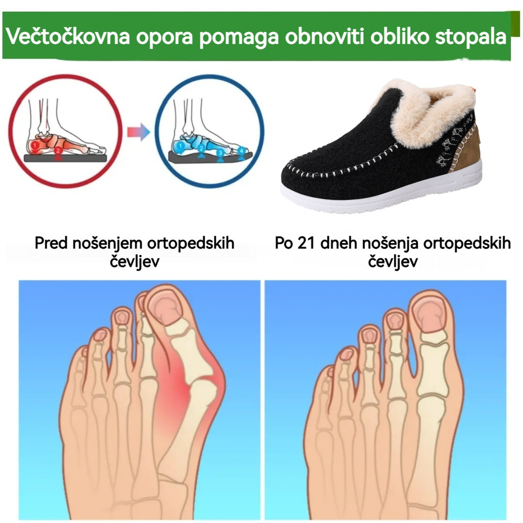 🔥Časovno omejena ponudba, danes 70 % popust! ⏰ - VERNOAN® nedrseči, topli pohodni čevlji, znanstveno zasnovani ortopedski čevlji, ki učinkovito lajšajo bolečine v stopalih, hrbtu in kolenih!