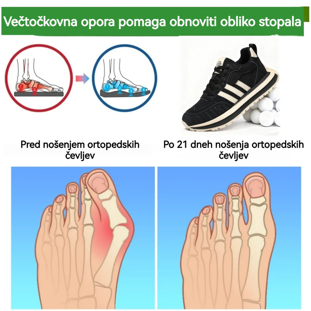 (⏰50 % popust! 🔥Samo danes!) Udobni, nedrseči čevlji vam bodo olajšali bolečine v nogah!
