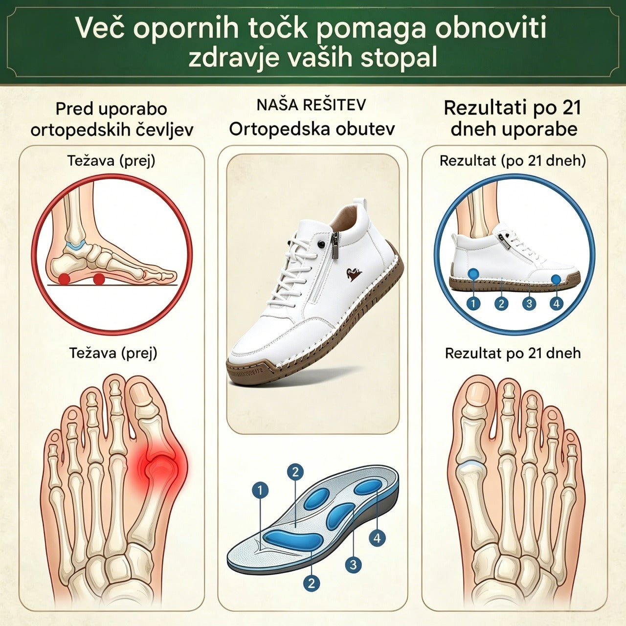 (🔥 50 % popusta – Ne zamudite!) Izbrana obutev iz telečje kože – ortopedski čevlji – 👞 – trpežni, nedrseči in vodoodporni (podpora stopalnega loka, lajšanje bolečin, unisex)